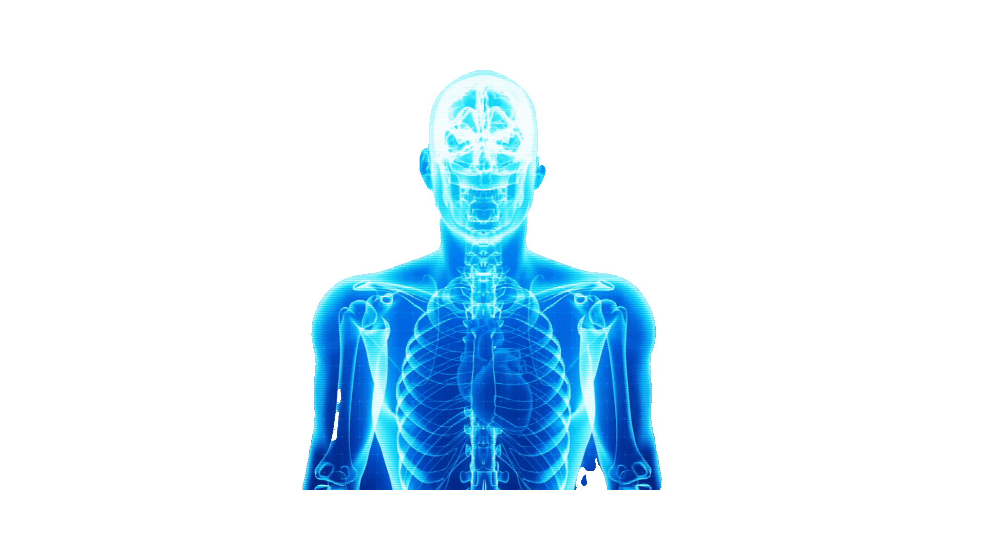 Animação Radiologia RadioMatch